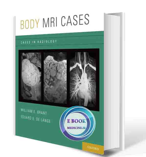 دانلود کتاب Body MRI Cases - (Cases in Radiology) (ORIGINAL PDF)